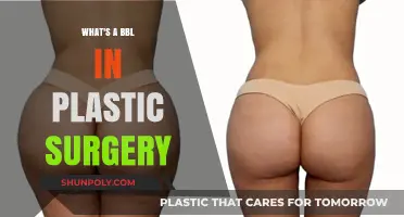 Understanding BBL: Brazilian Butt Lift Explained in Plastic Surgery