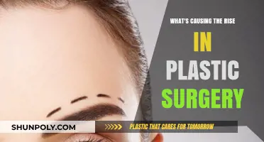 Exploring the Factors Fueling the Surge in Plastic Surgery Trends