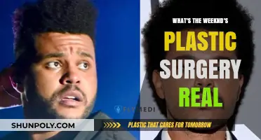 The Weeknd's Plastic Surgery: Fact-Checking the Rumors and Reality