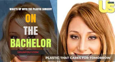 The Bachelor's Plastic Surgery Trend: Unveiling the Contestants' Transformations