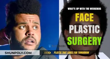 Weekend Face Plastic Surgery Trend: What's Behind the Sudden Popularity?