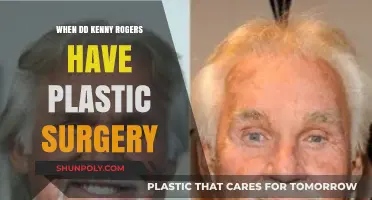 Kenny Rogers' Plastic Surgery Journey: When and Why He Changed