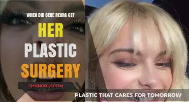 Bebe Rexha's Plastic Surgery Transformation: Timeline and Details Revealed