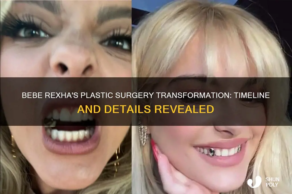 when did bebe rexha get her plastic surgery