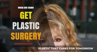 Charo's Plastic Surgery Transformation: Unveiling Her Journey and Timeline