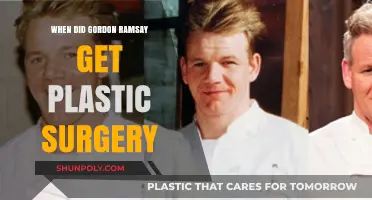 Gordon Ramsay's Plastic Surgery: Unveiling the Chef's Transformation Timeline
