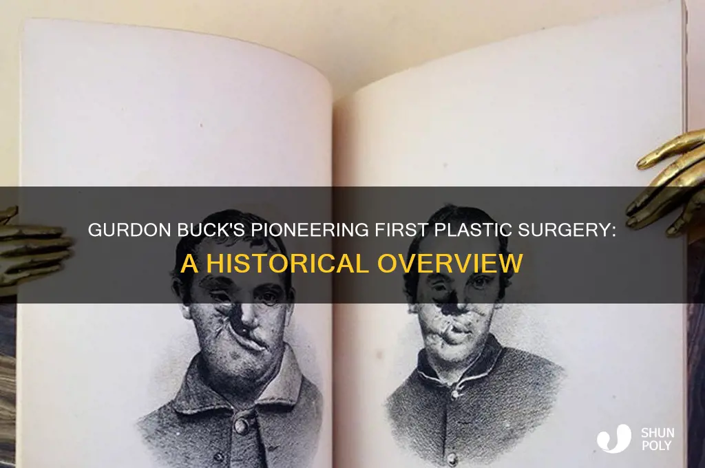 when did gurdon buck do his first plastic surgery