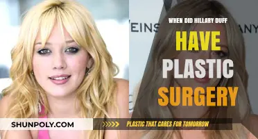 Hillary Duff's Plastic Surgery Journey: Timeline and Transformation Revealed