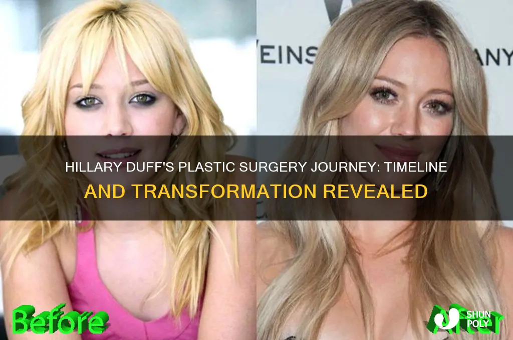 when did hillary duff have plastic surgery