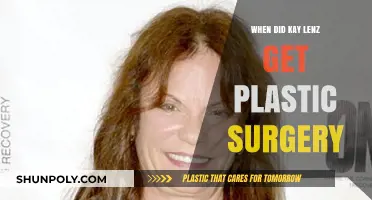 Kay Lenz's Plastic Surgery Transformation: Timeline and Details Revealed