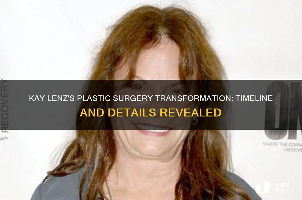 when did kay lenz get plastic surgery