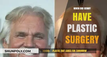 Kenny's Plastic Surgery Transformation: Unveiling the Timeline and Details