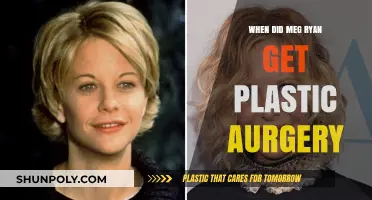 Meg Ryan's Plastic Surgery Transformation: Timeline and Impact
