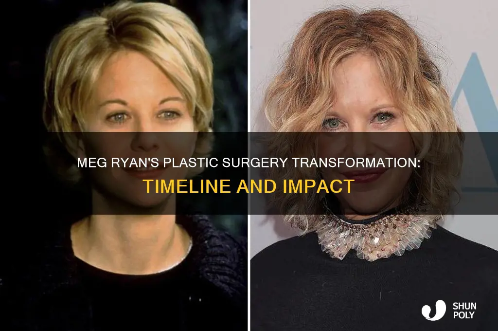 when did meg ryan get plastic aurgery