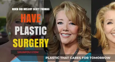 Melody Scott Thomas Plastic Surgery: Unveiling Her Transformation Journey