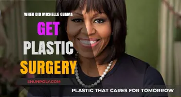 Michelle Obama's Plastic Surgery Speculations: Fact-Checking the Timeline