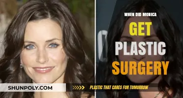 Monica's Plastic Surgery Transformation: Unveiling the Timeline and Details