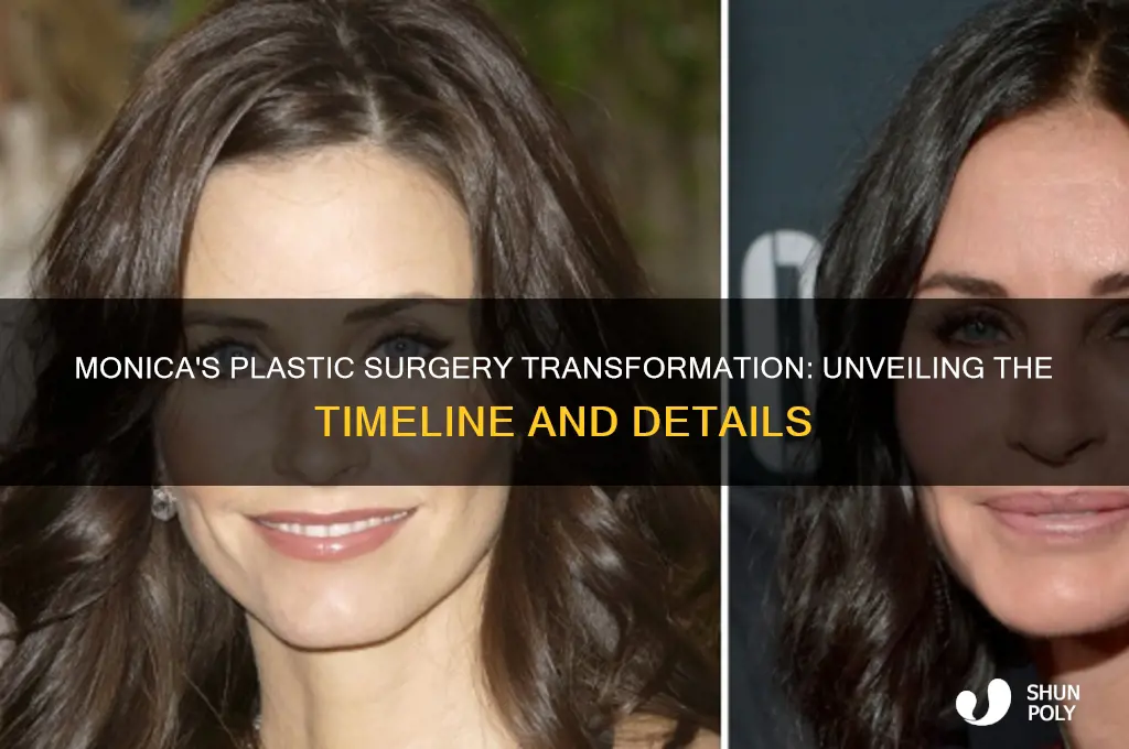when did monica get plastic surgery