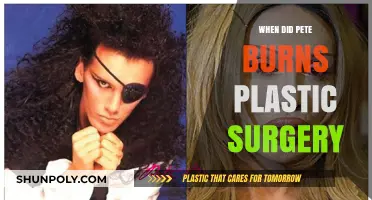 Pete Burns' Plastic Surgery Journey: Transformation Timeline and Impact