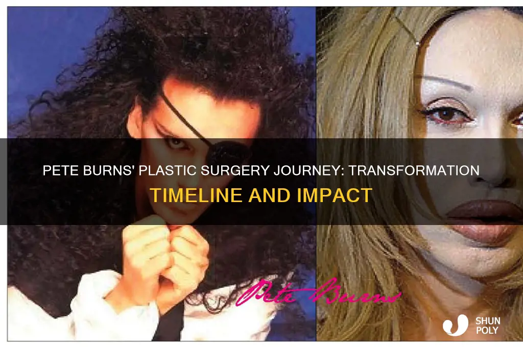 when did pete burns plastic surgery