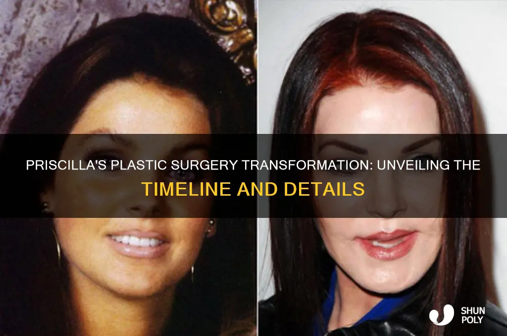 when did priscilla get plastic surgery