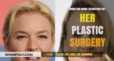 Renee Zellweger's Transformation: Unveiling Her Plastic Surgery Timeline