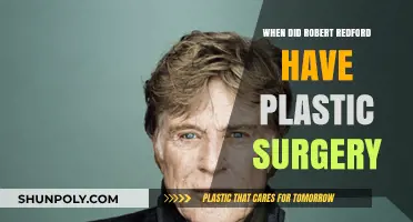 Robert Redford's Plastic Surgery: Unveiling the Truth Behind His Timeless Look