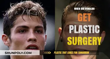 Cristiano Ronaldo's Plastic Surgery: Unveiling the Truth Behind the Rumors