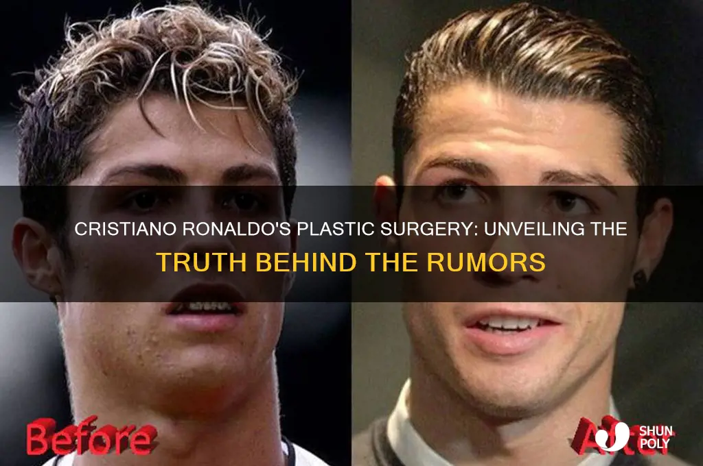 when did ronaldo get plastic surgery