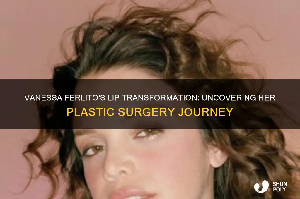 when did vanessa ferlito get plastic surgery on her lips