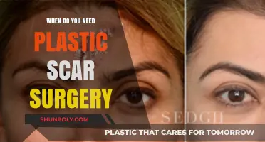 When to Consider Plastic Scar Surgery: A Comprehensive Guide
