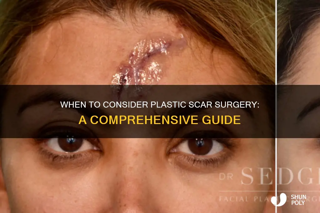 when do you need plastic scar surgery