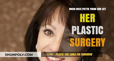 Pattie's Transformation: Unveiling Her Plastic Surgery Journey in GND