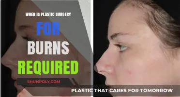 When Is Plastic Surgery Necessary for Burn Victims: A Guide