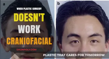 Craniofacial Plastic Surgery Failures: Risks, Realities, and Recovery Options