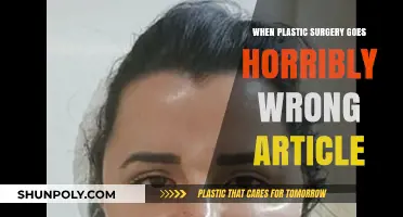 Botched Beauty: Devastating Consequences of Plastic Surgery Gone Wrong