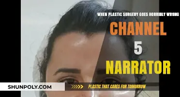 Botched Beauty: Channel 5 Narrator Exposes Plastic Surgery Nightmares