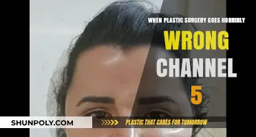 Botched Beauty: Channel 5 Exposes Plastic Surgery Nightmares and Tragedies