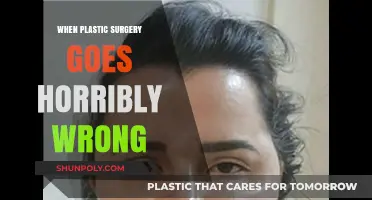 Botched Beauty: Devastating Consequences of Plastic Surgery Gone Wrong