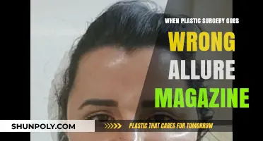 Plastic Surgery Nightmares: Allure Magazine Exposes Botched Procedures and Risks
