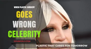 Celebrity Plastic Surgery Disasters: When Enhancements Turn into Nightmares