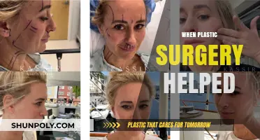 Transforming Lives: When Plastic Surgery Became a Healing Solution
