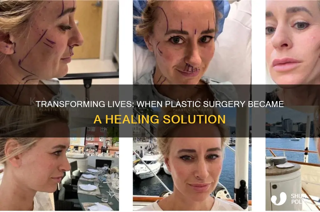 when plastic surgery helped