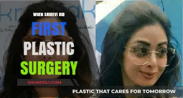 Sridevi's First Plastic Surgery: Unveiling Bollywood's Iconic Transformation
