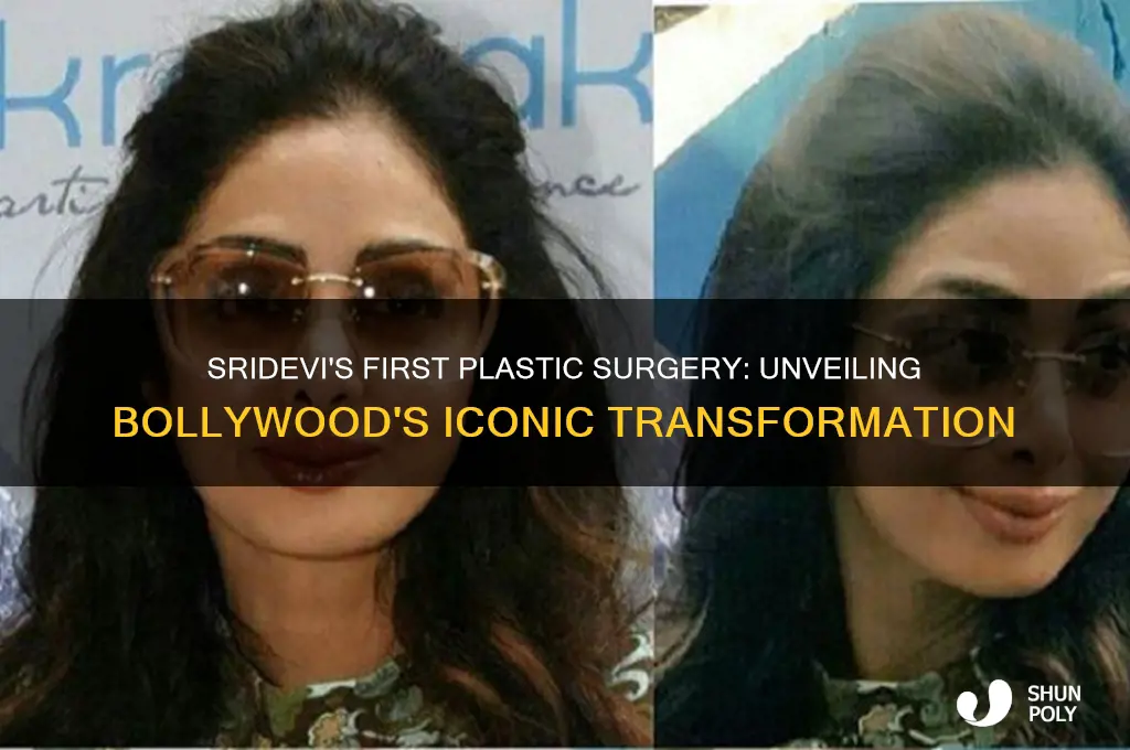 when sridevi did first plastic surgery
