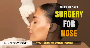 Ideal Timing for Rhinoplasty: When to Consider Nose Surgery