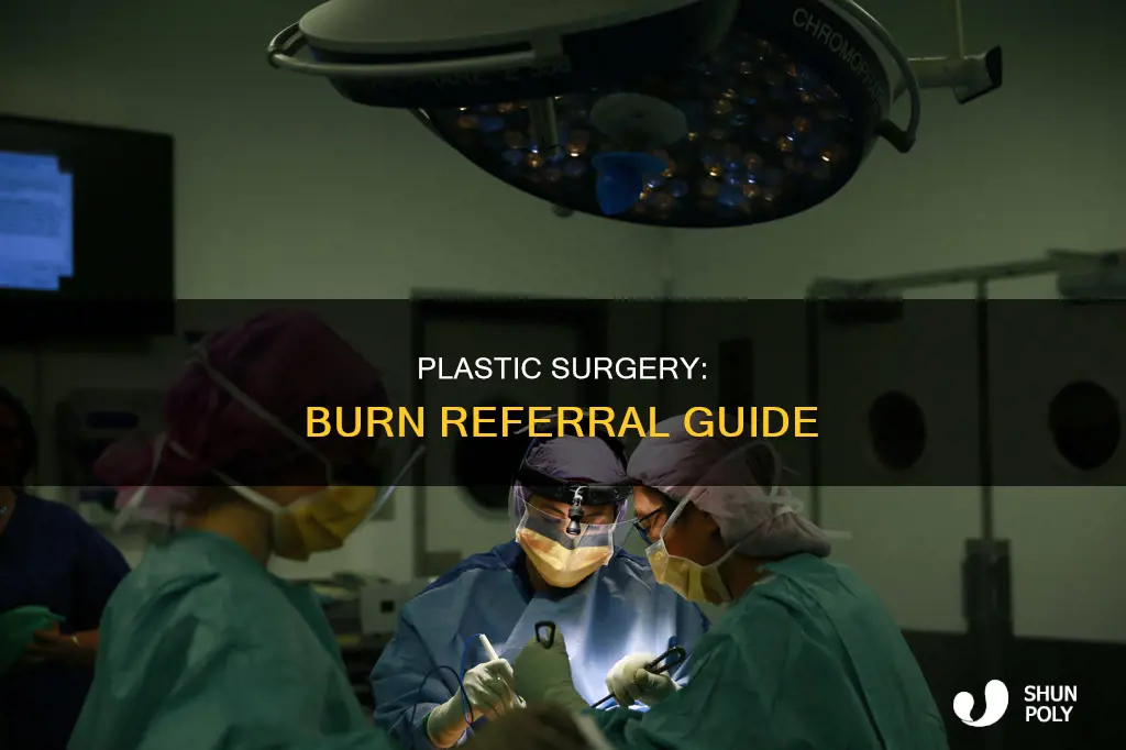 when to refer burns to plastics