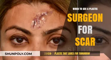When to Consult a Plastic Surgeon for Scar Revision: A Guide