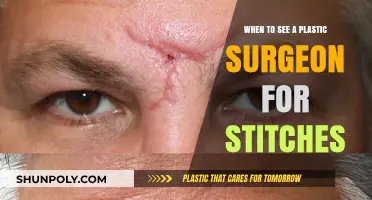 When to Consult a Plastic Surgeon for Stitches: Expert Timing Tips