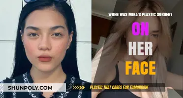 Mika's Facial Transformation: Unveiling the Timeline of Her Plastic Surgery